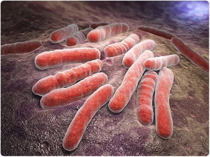 Increasing Global Threats: Tuberculosis and COVID-19 Co-infection Raises Concerns. Credit | Shutterstock